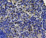 CDK1 Antibody in Immunohistochemistry (Paraffin) (IHC (P))