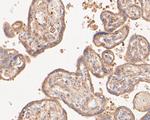 GADD34 Antibody in Immunohistochemistry (Paraffin) (IHC (P))