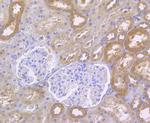 RIP3 Antibody in Immunohistochemistry (Paraffin) (IHC (P))