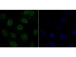 delta Catenin Antibody in Immunocytochemistry (ICC/IF)