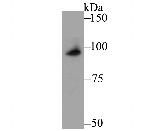 delta Catenin Antibody in Western Blot (WB)