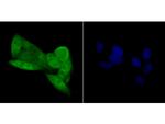 p16INK4a Antibody in Immunocytochemistry (ICC/IF)