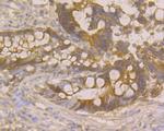 p16INK4a Antibody in Immunohistochemistry (Paraffin) (IHC (P))