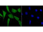 BUBR1 Antibody in Immunocytochemistry (ICC/IF)