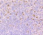 BUBR1 Antibody in Immunohistochemistry (Paraffin) (IHC (P))