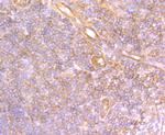 Securin Antibody in Immunohistochemistry (Paraffin) (IHC (P))