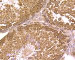 Securin Antibody in Immunohistochemistry (Paraffin) (IHC (P))