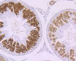 Securin Antibody in Immunohistochemistry (Paraffin) (IHC (P))