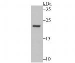 Securin Antibody in Western Blot (WB)