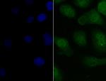 PAX8 Antibody in Immunocytochemistry (ICC/IF)