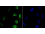 APE1 Antibody in Immunocytochemistry (ICC/IF)