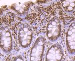 APE1 Antibody in Immunohistochemistry (Paraffin) (IHC (P))