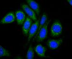 Osteopontin Antibody in Immunocytochemistry (ICC/IF)