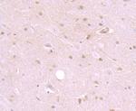 SHP2 Antibody in Immunohistochemistry (Paraffin) (IHC (P))