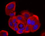 NME1 Antibody in Immunocytochemistry (ICC/IF)