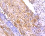 NME1 Antibody in Immunohistochemistry (Paraffin) (IHC (P))