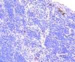 NOX2 Antibody in Immunohistochemistry (Paraffin) (IHC (P))