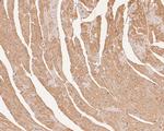 Ly-6G Antibody in Immunohistochemistry (Paraffin) (IHC (P))