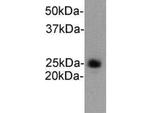 Ly-6G Antibody in Western Blot (WB)