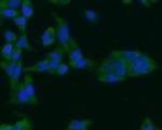 ARF1 Antibody in Immunocytochemistry (ICC/IF)