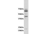 CSF2RA Antibody in Western Blot (WB)