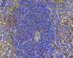 CD24 Antibody in Immunohistochemistry (Paraffin) (IHC (P))