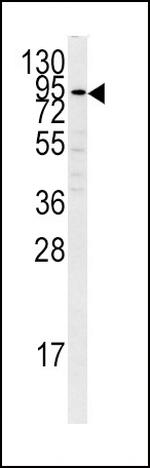 Plasminogen Antibody in Western Blot (WB)