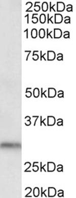 DAPP1 Antibody in Western Blot (WB)