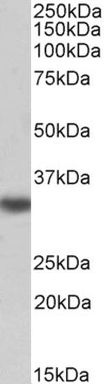 TMX Antibody in Western Blot (WB)