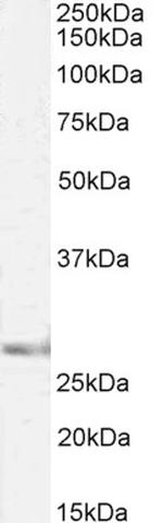 SIAH1 Antibody in Western Blot (WB)