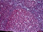 SH3KBP1 Antibody in Immunohistochemistry (Paraffin) (IHC (P))