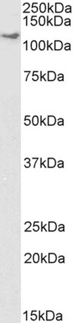 Kinesin 5B Antibody in Western Blot (WB)