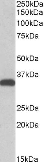 CBR3 Antibody in Western Blot (WB)