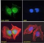 GATA1 Antibody in Immunocytochemistry (ICC/IF)