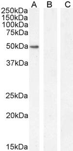 GATA1 Antibody in Western Blot (WB)