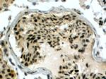 RAD51AP1 Antibody in Immunohistochemistry (Paraffin) (IHC (P))