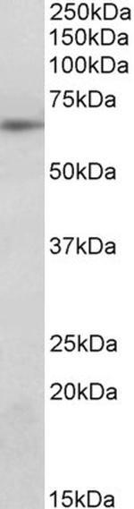 SOCS5 Antibody in Western Blot (WB)