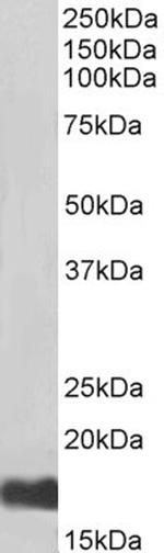 UBC9 Antibody in Western Blot (WB)