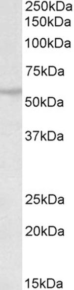 RNF36 Antibody in Western Blot (WB)