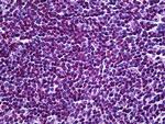 HYD Antibody in Immunohistochemistry (Paraffin) (IHC (P))