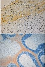 JIP3 Antibody in Immunohistochemistry (Paraffin) (IHC (P))