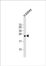 MSRA Antibody in Western Blot (WB)