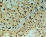 REV1 Antibody in Immunohistochemistry (Paraffin) (IHC (P))