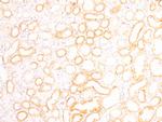 FOXD1 Antibody in Immunohistochemistry (Paraffin) (IHC (P))