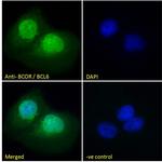 BCOR Antibody in Immunocytochemistry (ICC/IF)