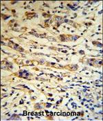 A1BG Antibody in Immunohistochemistry (Paraffin) (IHC (P))