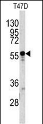 A1BG Antibody in Western Blot (WB)