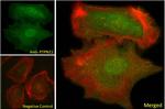 PTPN22 Antibody in Immunocytochemistry (ICC/IF)