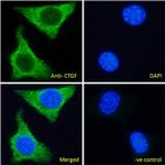 CTGF Antibody in Immunocytochemistry (ICC/IF)