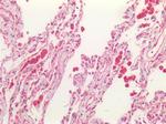 CFTR Antibody in Immunohistochemistry (Paraffin) (IHC (P))